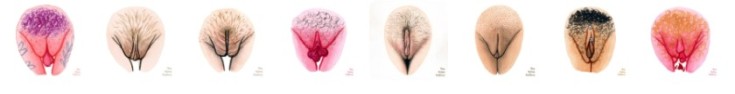 (+15 фото) Какие бывают вагины у девушек